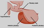 Thumbnail for File:Pituitary-gland-lobes.jpg